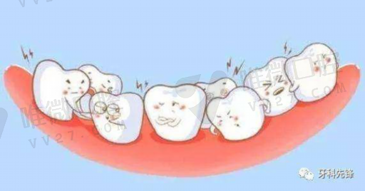 牙齿嵌体的优势（嵌体的好处）